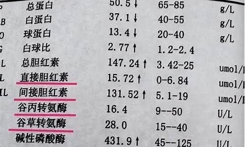 体检当天转氨酶必过方法,高考体检转氨酶标准